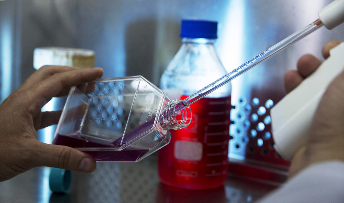 Estudian la relación entre el Alzheimer y la Osteoporosis en la Universidad Nacional de La Plata
